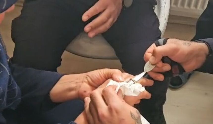 Parmağına sıkışan yüzüğü itfaiye çıkardı